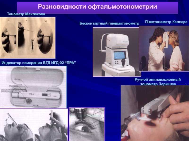 Диагностика в офтальмологии: тонометрия по маклакову